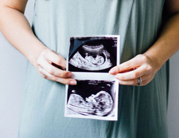 Smiling woman holding pregnancy scan prints over belly.